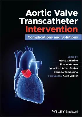 Interwencja przezcewnikowa zastawki aortalnej: Powikłania i rozwiązania - Aortic Valve Transcatheter Intervention: Complications and Solutions