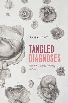 Zaplątane diagnozy: Testy prenatalne, kobiety i ryzyko - Tangled Diagnoses: Prenatal Testing, Women, and Risk