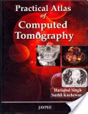 Praktyczny atlas tomografii komputerowej - Practical Atlas of Computed Tomography