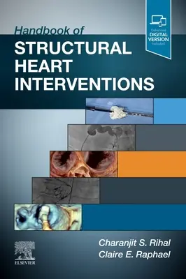 Podręcznik strukturalnych interwencji serca - Handbook of Structural Heart Interventions