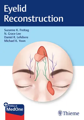 Rekonstrukcja powiek - Eyelid Reconstruction