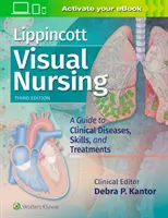 Lippincott Visual Nursing: Przewodnik po chorobach klinicznych, umiejętnościach i leczeniu - Lippincott Visual Nursing: A Guide to Clinical Diseases, Skills, and Treatments