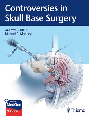 Kontrowersje w chirurgii podstawy czaszki - Controversies in Skull Base Surgery