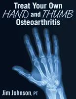 Leczenie choroby zwyrodnieniowej stawów rąk i kciuków - Treat Your Own Hand and Thumb Osteoarthritis