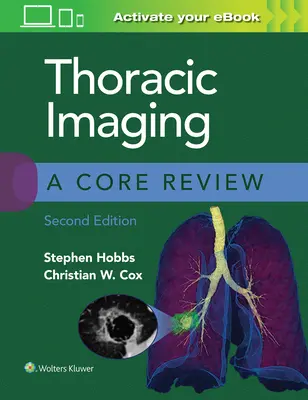 Obrazowanie klatki piersiowej: A Core Review - Thoracic Imaging: A Core Review