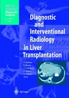 Radiologia diagnostyczna i interwencyjna w transplantacji wątroby - Diagnostic and Interventional Radiology in Liver Transplantation