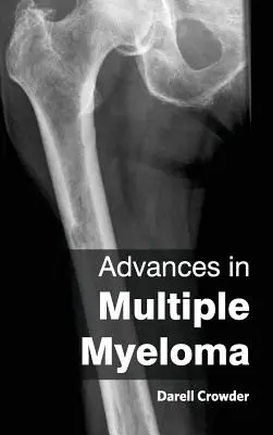 Postępy w szpiczaku mnogim - Advances in Multiple Myeloma