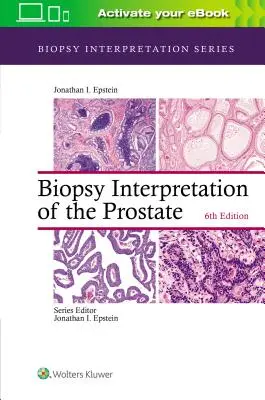 Interpretacja biopsji gruczołu krokowego - Biopsy Interpretation of the Prostate