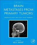 Przerzuty do mózgu z guzów pierwotnych, tom 2: epidemiologia, biologia i terapia - Brain Metastases from Primary Tumors, Volume 2: Epidemiology, Biology, and Therapy