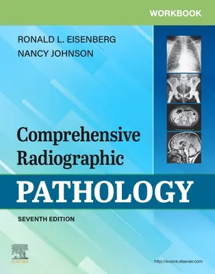 Zeszyt ćwiczeń do kompleksowej patologii radiograficznej - Workbook for Comprehensive Radiographic Pathology