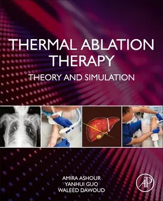 Termiczna terapia ablacyjna: Teoria i symulacja - Thermal Ablation Therapy: Theory and Simulation