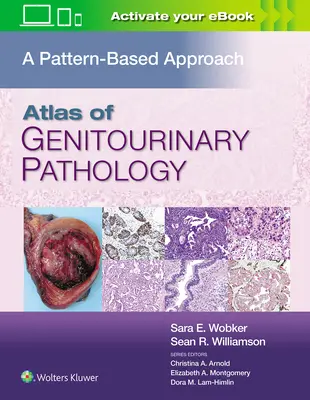 Atlas patologii układu moczowo-płciowego: A Pattern Based Approach - Atlas of Genitourinary Pathology: A Pattern Based Approach