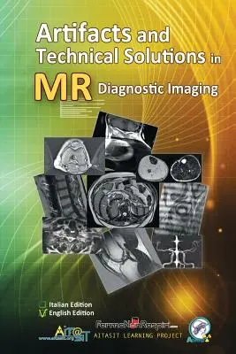 Artefakty i rozwiązania techniczne w obrazowaniu diagnostycznym MR - Artifacts and Technical Solutions in MR Diagnostic Imaging