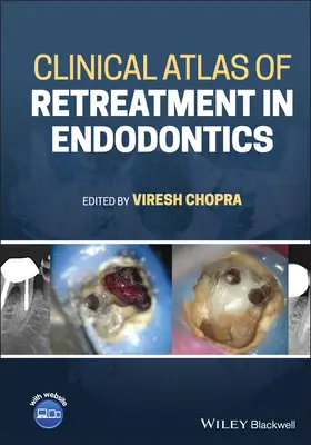 Atlas kliniczny leczenia kanałowego w endodoncji - Clinical Atlas of Retreatment in Endodontics