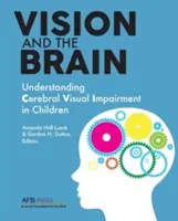 Wzrok i mózg: Zrozumienie mózgowego upośledzenia wzroku u dzieci - Vision and the Brain: Understanding Cerebral Visual Impairment in Children