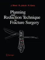 Technika planowania i redukcji w chirurgii złamań - Planning and Reduction Technique in Fracture Surgery