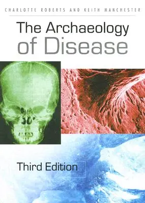 Archeologia chorób - The Archaeology of Disease