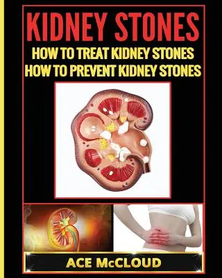 Kamienie nerkowe: Jak leczyć kamienie nerkowe: Jak zapobiegać kamicy nerkowej - Kidney Stones: How To Treat Kidney Stones: How To Prevent Kidney Stones