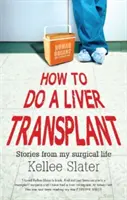 Jak zrobić przeszczep wątroby: Historie z mojego chirurgicznego życia - How to do a liver transplant: Stories from my surgical life