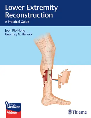 Rekonstrukcja kończyn dolnych: Praktyczny przewodnik - Lower Extremity Reconstruction: A Practical Guide