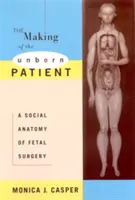 The Making of the Unborn Patient: Społeczna anatomia chirurgii płodu - The Making of the Unborn Patient: A Social Anatomy of Fetal Surgery