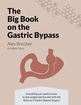 The BIG Book on the Gastric Bypass: Wszystko, co musisz wiedzieć, aby schudnąć i dobrze żyć dzięki operacji pomostowania żołądka Roux-en-Y - The BIG Book on the Gastric Bypass: Everything You Need To Know To Lose Weight and Live Well with the Roux-en-Y Gastric Bypass Surgery