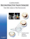 Carpentier's Reconstructive Valve Surgery: Od analizy zastawki do jej rekonstrukcji - Carpentier's Reconstructive Valve Surgery: From Valve Analysis to Valve Reconstruction