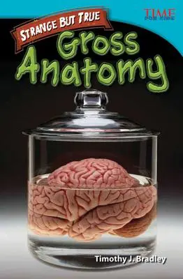 Dziwne, ale prawdziwe: Gruba anatomia - Strange but True: Gross Anatomy