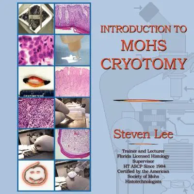 Wprowadzenie do kriotomii MOHS - Introduction to MOHS Cryotomy