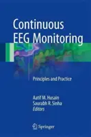 Ciągłe monitorowanie EEG: Zasady i praktyka - Continuous Eeg Monitoring: Principles and Practice