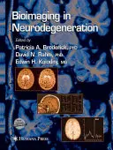 Bioobrazowanie w neurodegeneracji - Bioimaging in Neurodegeneration