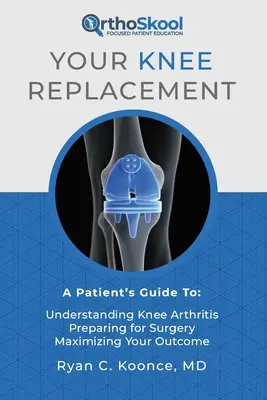 Wymiana stawu kolanowego: A Patient's Guide To: Zrozumienie zapalenia stawu kolanowego, Przygotowanie do operacji, Maksymalizacja wyników - Your Knee Replacement: A Patient's Guide To: Understanding Knee Arthritis, Preparing for Surgery, Maximizing Your Outcome