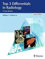 3 najważniejsze rozpoznania w radiologii: Przegląd przypadków - Top 3 Differentials in Radiology: A Case Review