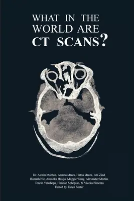 Czym na świecie jest tomografia komputerowa? - What in the World are CT Scans?