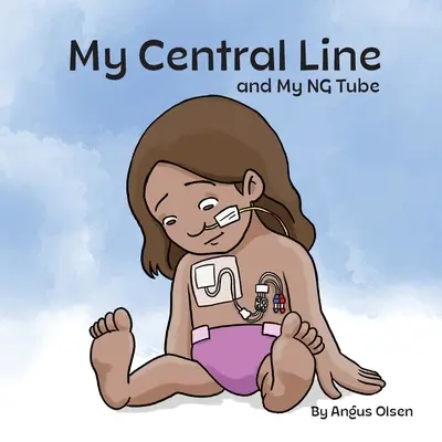 Moja linia centralna i rurka NG - My Central Line and My NG Tube