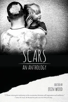 Blizny: Antologia - Scars: An Anthology