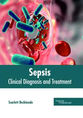 Sepsa: Diagnostyka kliniczna i leczenie - Sepsis: Clinical Diagnosis and Treatment