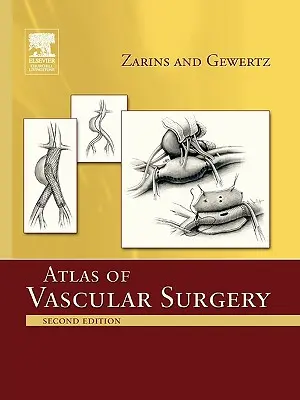 Atlas chirurgii naczyniowej - wydanie w miękkiej oprawie - Atlas of Vascular Surgery - Paperback Edition