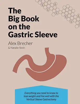 The Big Book on the Gastric Sleeve: Wszystko, co musisz wiedzieć, aby schudnąć i dobrze żyć dzięki pionowej rękawowej resekcji żołądka - The Big Book on the Gastric Sleeve: Everything You Need to Know to Lose Weight and Live Well with the Vertical Sleeve Gastrectomy