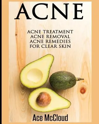 Trądzik: Leczenie trądziku: Usuwanie trądziku: Środki na trądzik dla czystej skóry - Acne: Acne Treatment: Acne Removal: Acne Remedies For Clear Skin