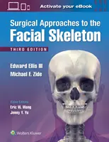 Chirurgiczne podejścia do szkieletu twarzy - Surgical Approaches to the Facial Skeleton