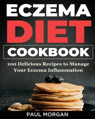 Eczema DIet Cookbook: 100 pysznych przepisów, aby poradzić sobie z zapaleniem egzemy - Eczema DIet Cookbook: 100 Delicious Recipes to Manage your Eczema Inflammation