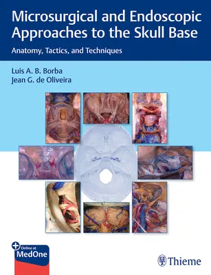 Mikrochirurgiczne i endoskopowe podejścia do podstawy czaszki: Anatomia, taktyka i techniki - Microsurgical and Endoscopic Approaches to the Skull Base: Anatomy, Tactics, and Techniques