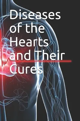 Choroby serca i ich leczenie - Diseases of the Hearts and Their Cures