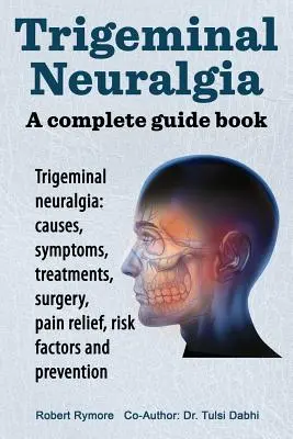 Neuralgia nerwu trójdzielnego: kompletny przewodnik. Neuralgia nerwu trójdzielnego: przyczyny, objawy, leczenie, chirurgia, - Trigeminal neuralgia: a complete guide book. Trigeminal neuralgia: causes, symptoms, treatments, surgery,