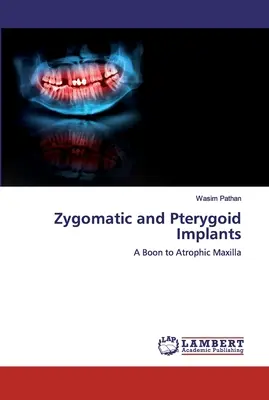 Implanty jarzmowe i skrzydłowe - Zygomatic and Pterygoid Implants