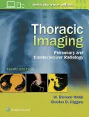 Obrazowanie klatki piersiowej: Radiologia płucna i sercowo-naczyniowa - Thoracic Imaging: Pulmonary and Cardiovascular Radiology