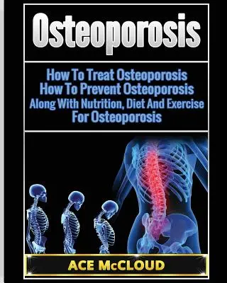 Osteoporoza: Jak leczyć osteoporozę: Jak zapobiegać osteoporozie: Wraz z odżywianiem, dietą i ćwiczeniami na osteoporozę - Osteoporosis: How To Treat Osteoporosis: How To Prevent Osteoporosis: Along With Nutrition, Diet And Exercise For Osteoporosis