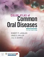 Kolorowy atlas powszechnych chorób jamy ustnej, wydanie rozszerzone - Color Atlas of Common Oral Diseases, Enhanced Edition