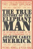 Prawdziwa historia człowieka-słonia - True History of the Elephant Man